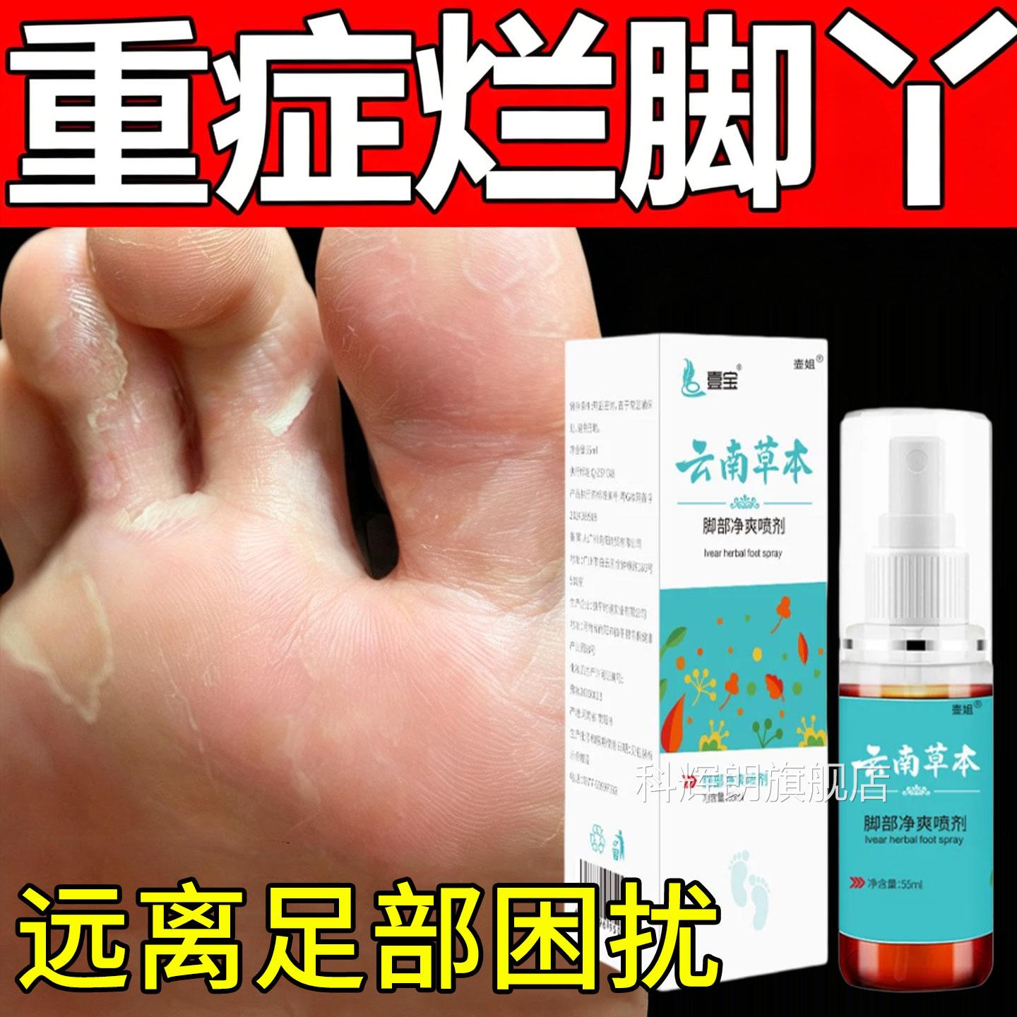 云南本草本脚爽喷剂脱皮草抑菌去烂脚丫药糜脚趾缝烂外用喷剂正品