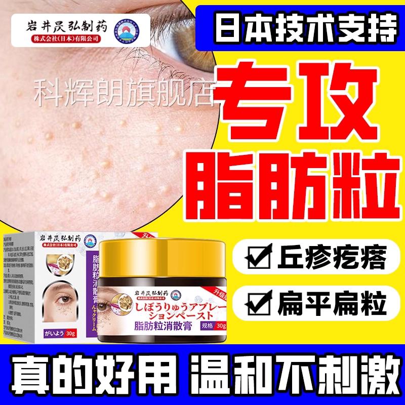日本专研眼部脂肪粒乳膏专用膏扁平粒深层渗透疏通毛正囊品旗舰店