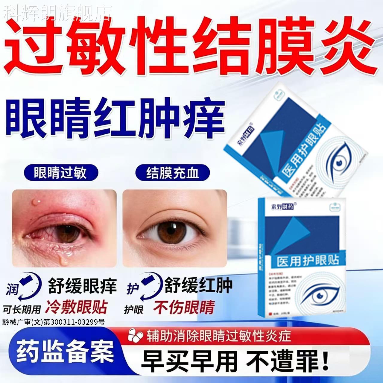 儿童过敏性结膜炎眼贴冰敷冷角膜炎眼睛痒红血丝可搭止痒眼药水BD