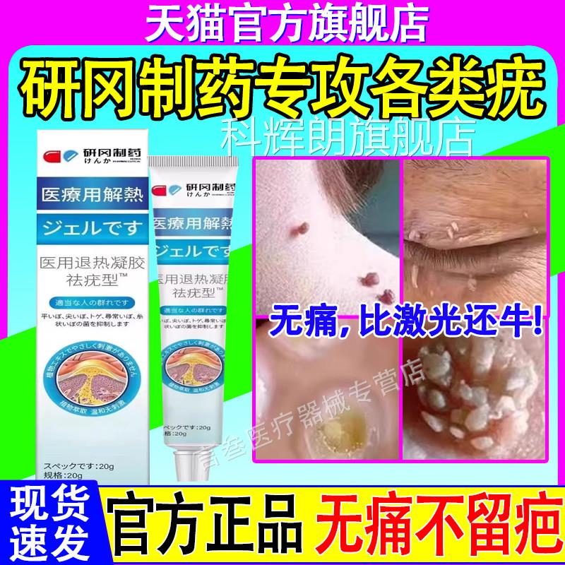 冈制药医用退热凝胶去优疣候疣清研宁型疣小肉粒扁平丝状官方正品