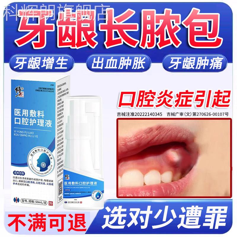 牙龈脓包肿痛专药喷剂用牙周炎增生息肉出血炎上火鼓包消智齿A科