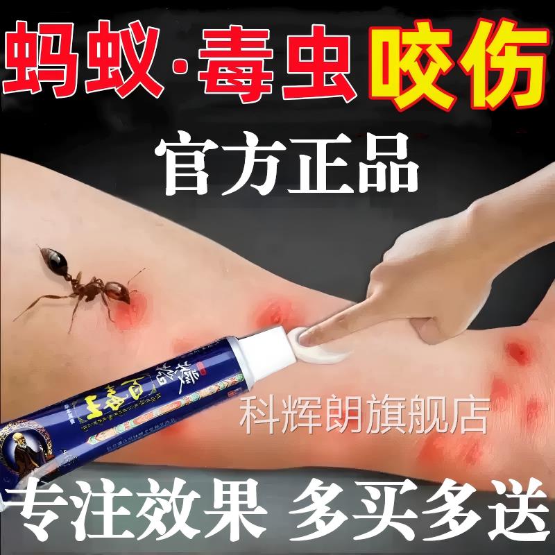 蚂蚁伤毒虫咬膏蚊虫叮咬隐翅虫跳蚤螨虫叮咬消肿外用抑止痒膏正品