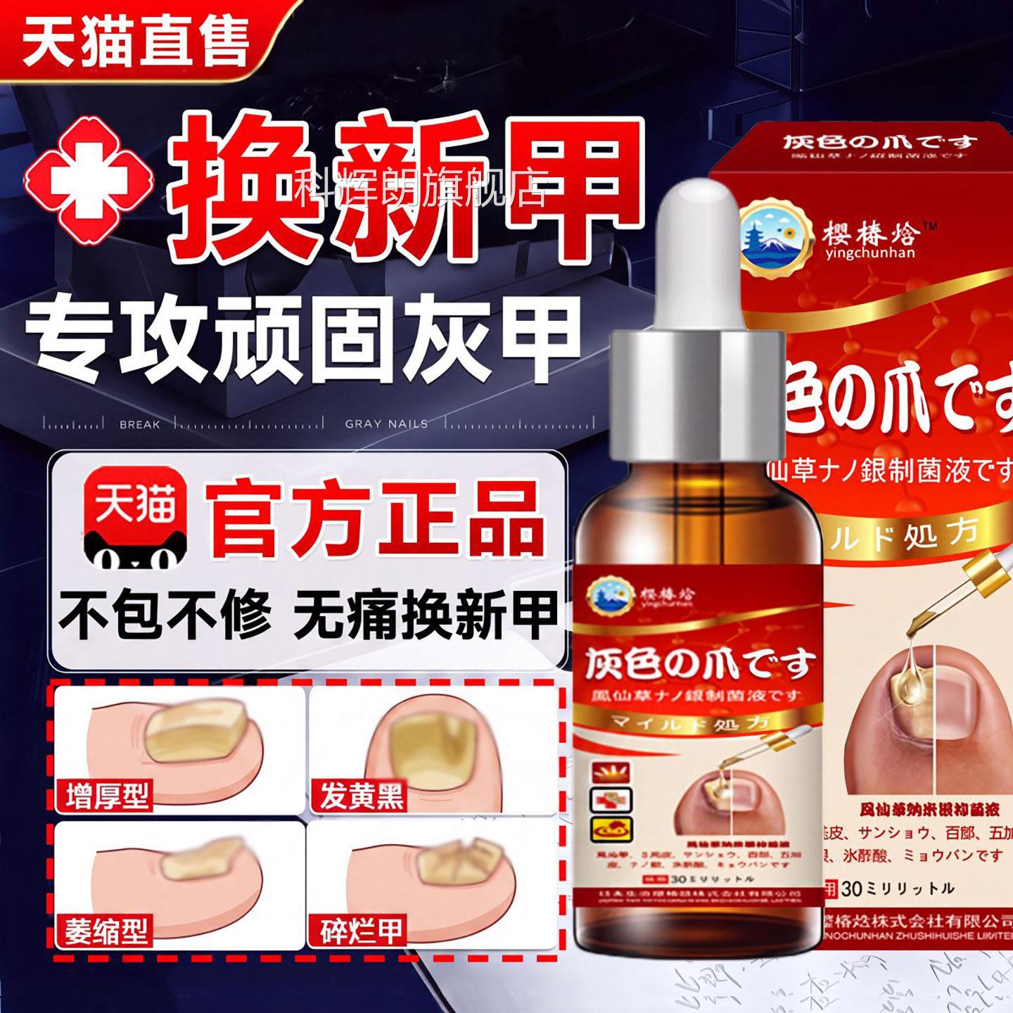 灰指甲凤仙花用药治疗灰指甲非日本进口脱专抑菌官方甲旗舰店正品