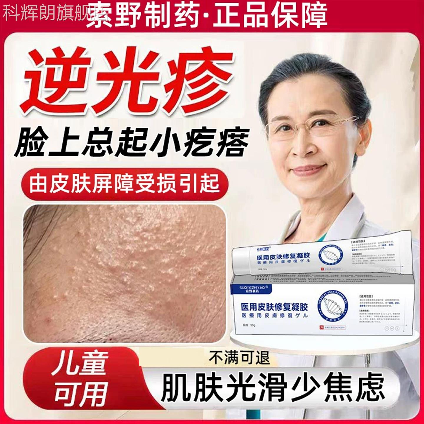 面部去逆光疹修小复儿童脸上起疙瘩闭口粉刺小颗粒屏障受损药膏TK