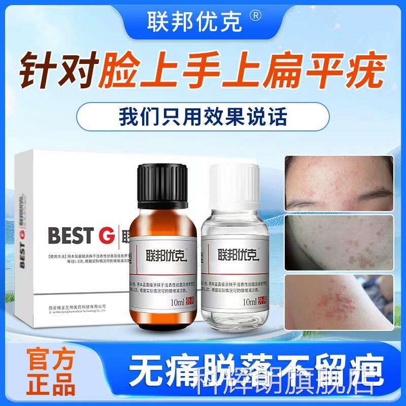 扁平疣专用去除软膏尤瘊一抹灵脖子长小肉无粒丝状尖锐湿疣神器忧