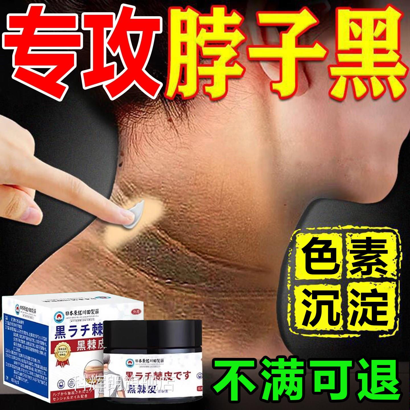 脖子黑色素去除黑棘皮脖子黑色素淀洗不沉干净肥胖神美白器科辉朗