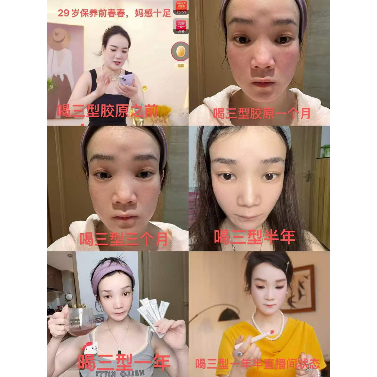 【 口服Y美Ⅲ型】春春本人真实反馈
