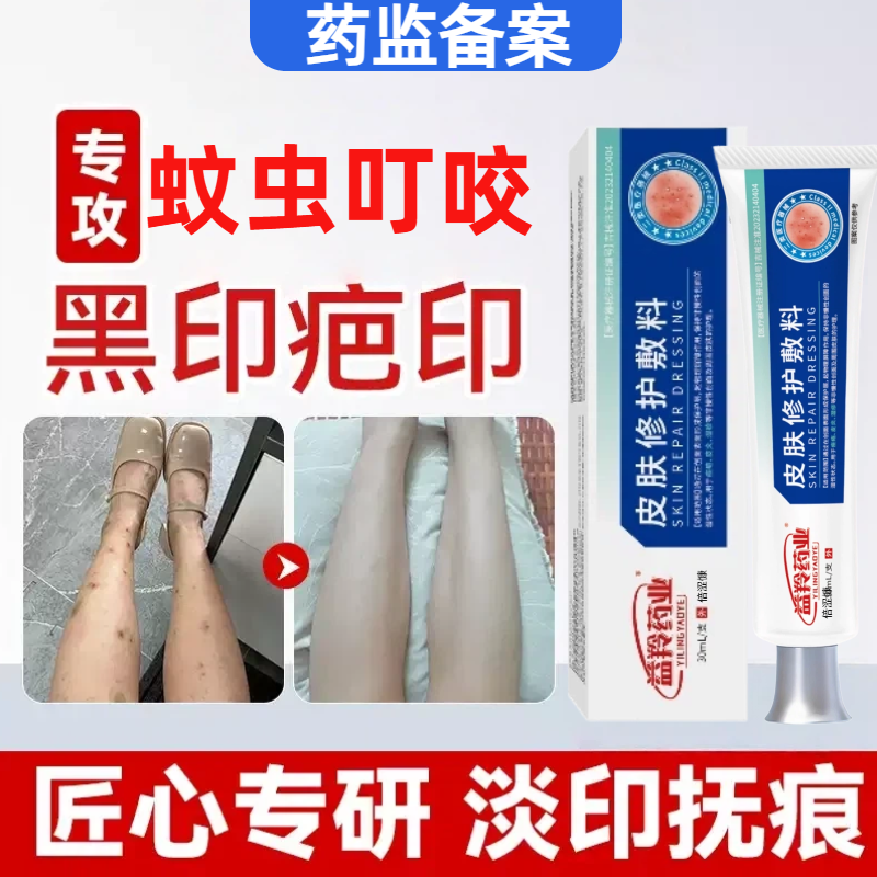 蚊虫叮咬祛疤膏去蚊子咬的疤痕印被虫子咬丘疹性荨麻疹止痒lm