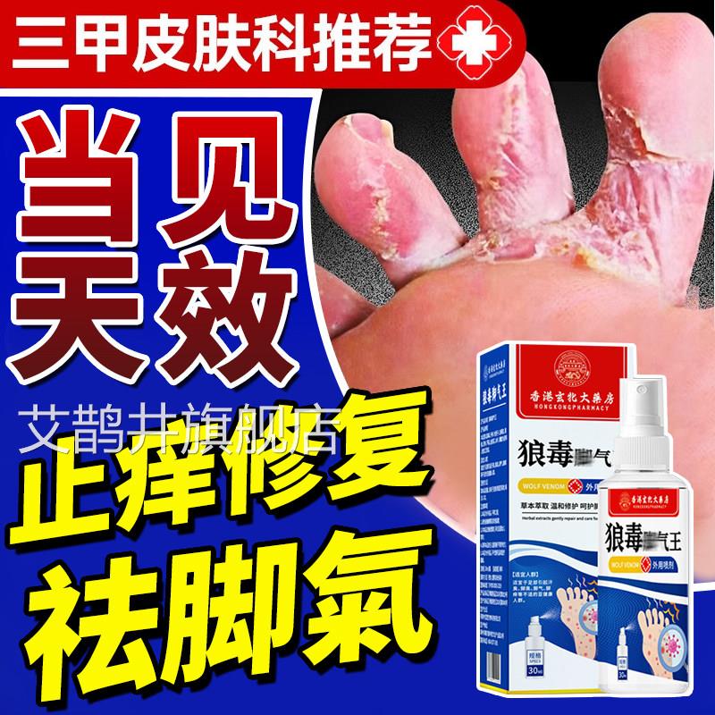 云南本草脚气喷雾止药膏脚臭脚痒脱皮去剂水泡烂脚丫脚用气痒艾鹊