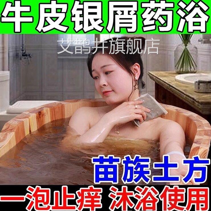 药牛皮藓药浴顽固银屑鲜专用泡澡中包皮肤瘙痒止痒抑无激素艾鹊井