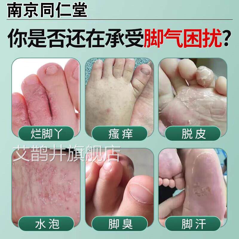 脚气脚烂丫药脱皮糜烂脚趾缝真菌感染水泡专喷剂用止痒杀菌去汗根