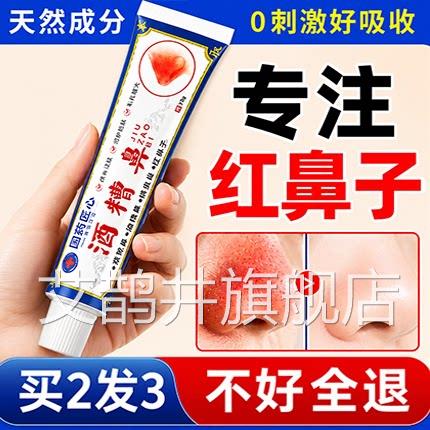 酒鼻红鼻子用软膏草莓鼻红血丝修复去除收缩毛孔粗大凝糟胶艾鹊井