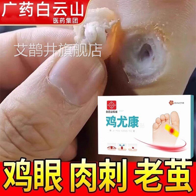 广药白云山鸡眼贴鸡眼部膏瘊子足去脚底脚趾手部跖疣灵老茧根肉刺