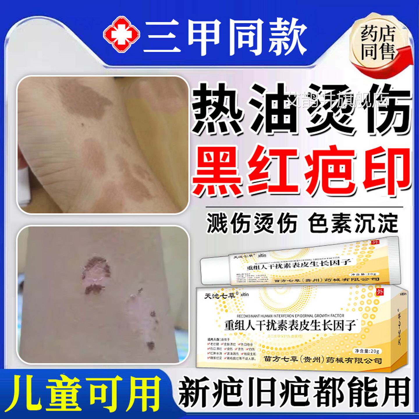 热油油烫伤烧伤去儿疤膏疤痕修复除疤膏童祛去红印黑印色素沉淀艾