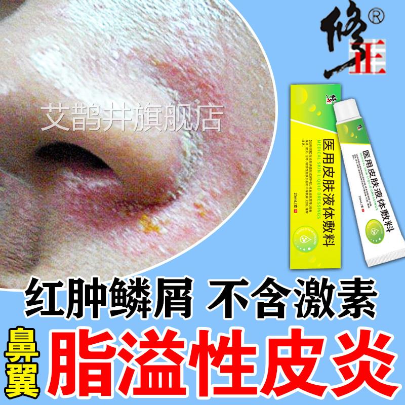 脂溢性翼皮炎面部药膏鼻眉间神经性皮炎鼻子发红脱皮干燥起皮正品