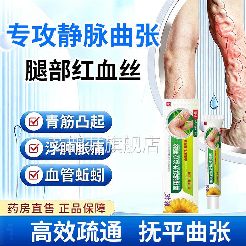 葵花静脉曲张型冷敷凝胶医用腿筋部青凸起专用膏药促进血液循环艾