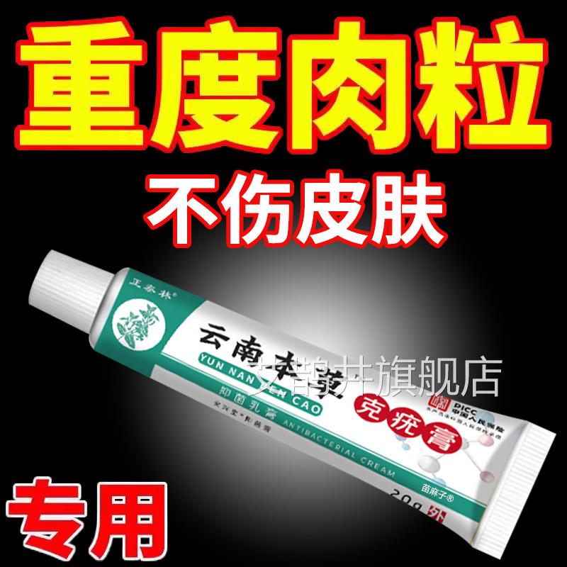 脖子丝状扁平尤克清尤克软膏祛尤灵佳克清软膏尤必净克优膏尤克净