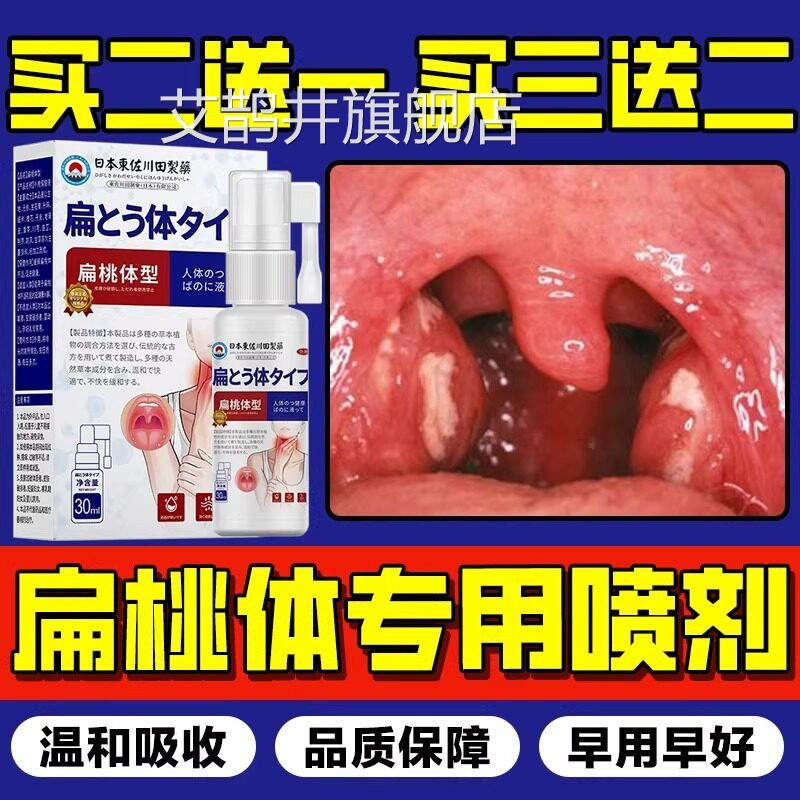 本特效扁桃体结石去除工具漱口水喷雾剂日溶解隐窝冲洗器清理喷剂