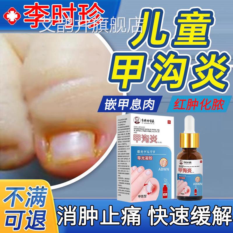 李时珍儿童甲沟炎治疗药用特去脚趾甲息专肉效嵌甲消肿软化脓药膏