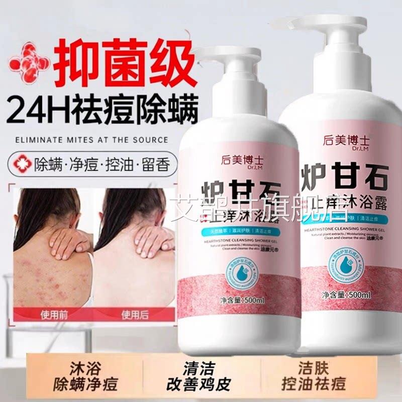 正炉甘石止痒洗剂沐浴露洗液外用毛囊后背炎祛痘除螨去鸡皮品官方
