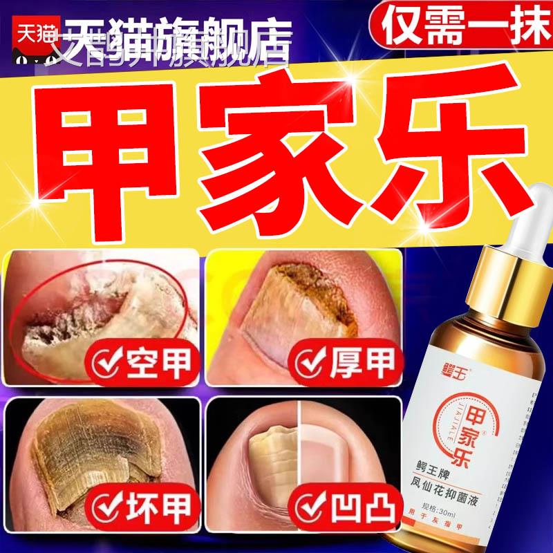 甲家乐凤仙花护理液官方旗舰店正品鳄牌甲王家乐抑菌液1er艾鹊井