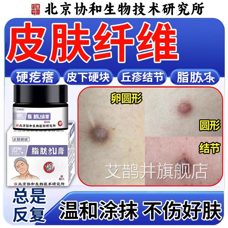 皮肤纤维肿膏块去除皮下脂瘤肪消瘤硬瘤块搭膏药贴皮下粉疙瘤瘩艾