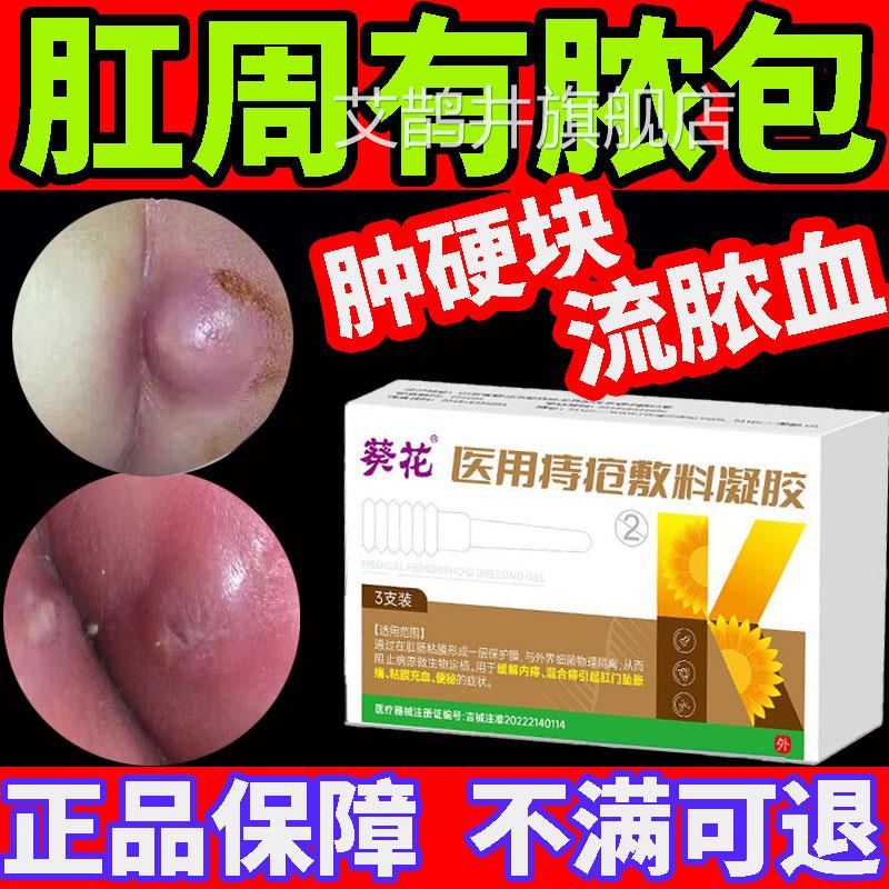 肛肛瘘内克口星肛裂愈周脓肿合膏大便出血肛门撕裂特封口效药膏物