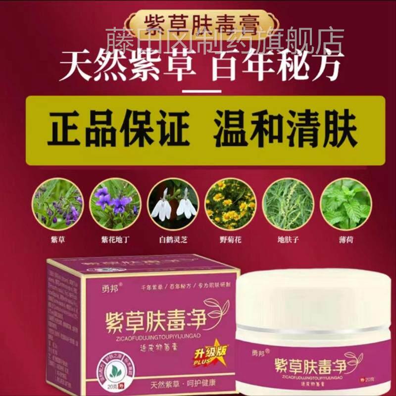 勇邦肤毒净透皮菌正克品紫膏草膏真菌抑克 星乳膏大MVH腿内外侧