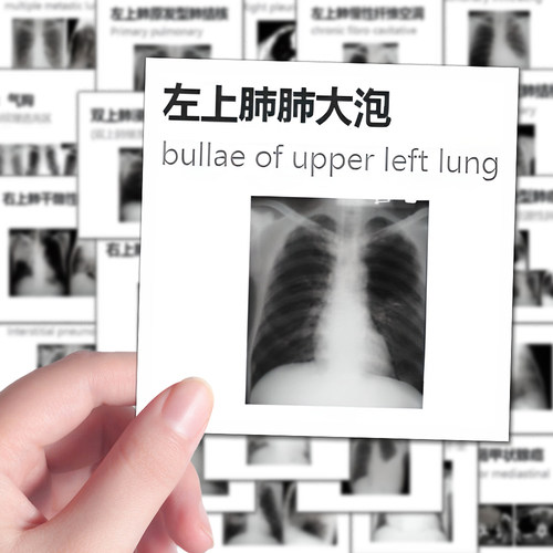 96张医学影像图解贴纸医学生入门笔记学习手机壳iPad贴画防水