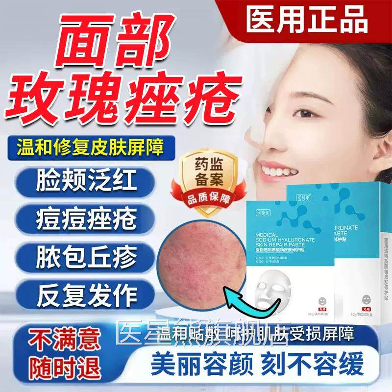 玫瑰长痤疮屏障修复专消抗炎舒缓修复面膜用敏感肌肤反复结节痘TZ