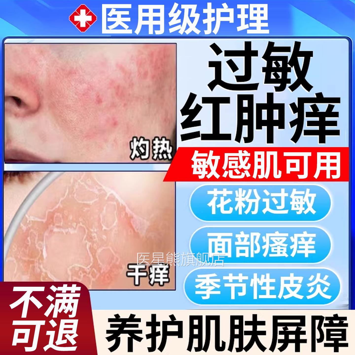 过敏皮肤脸部脸过敏红痒面敏感肌春季泛红干痒急补水修复屏障膜SK
