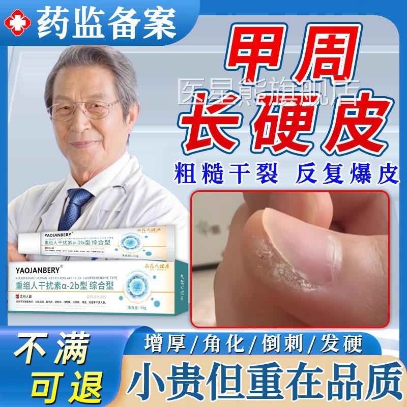 甲周硬皮指甲边缘医去死皮软化剂手部去角质开裂起硬皮老茧用级UU