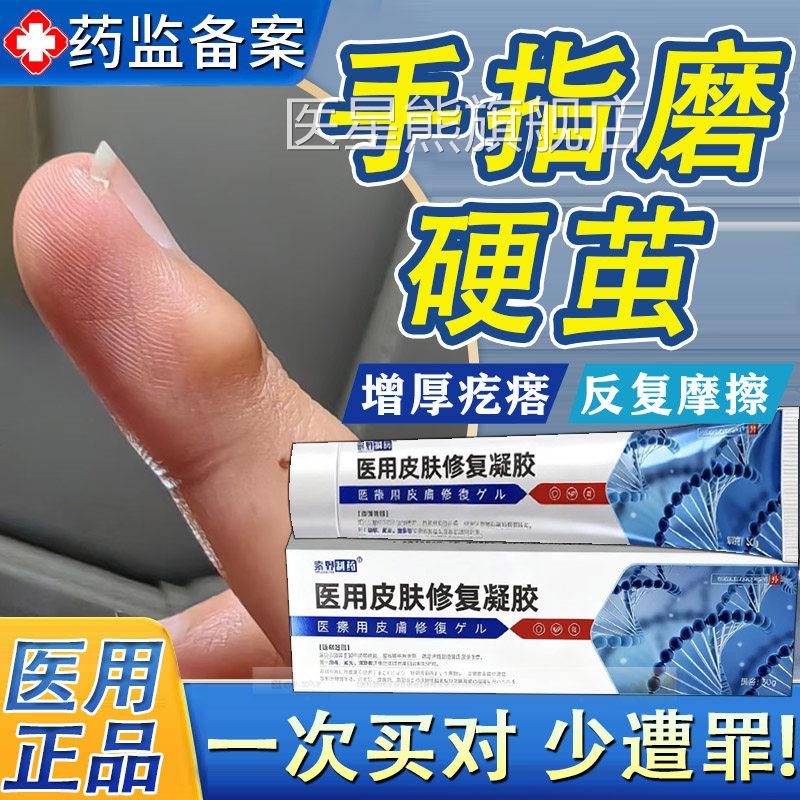 指头起写字茧手茧子去除神器手上长硬疙瘩去死皮老茧软化手剂膏TK