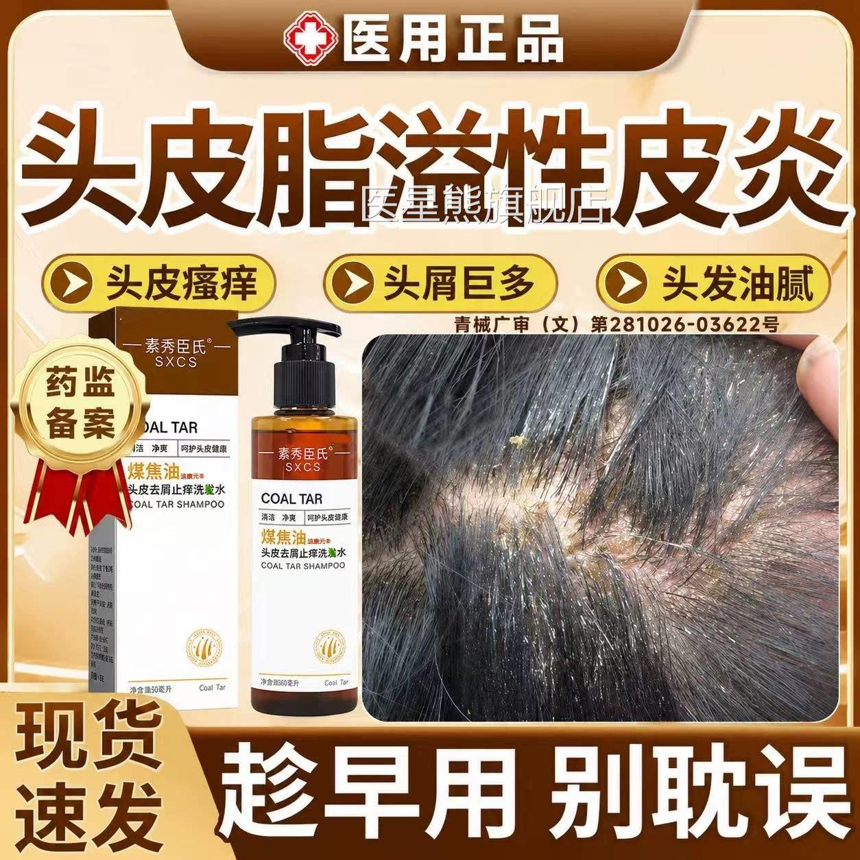 煤油焦油洗剂脂溢性皮炎去屑止痒洗发水头部毛囊炎去马色拉菌洗剂
