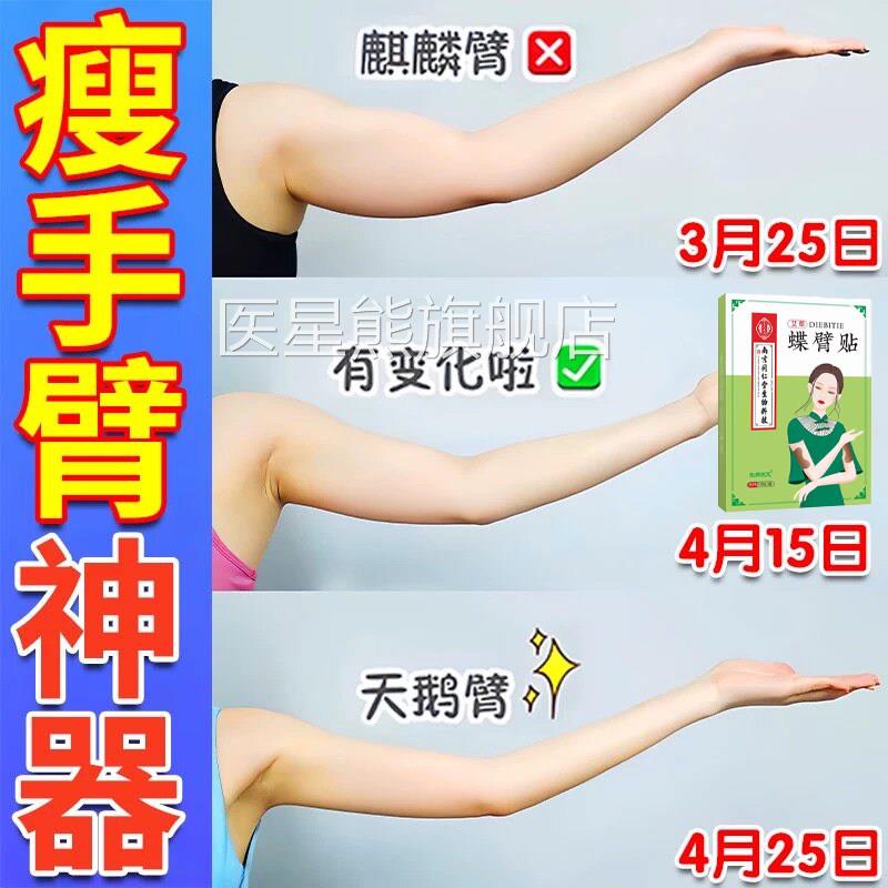 粗南京同仁堂艾草蝶臂贴官方旗舰店懒人瘦美麒麟手臂细胳膊正品医