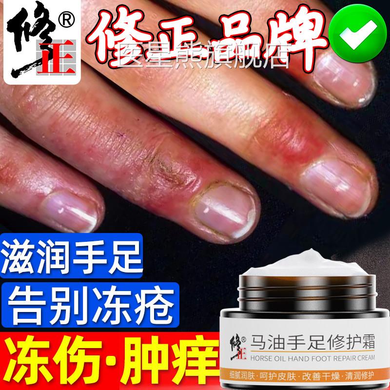 冻疮膏止痒冻伤膏正品儿童防裂口干裂冻手朵消肿防冻马油修耳复霜