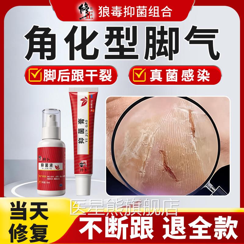 鳞屑角型脚气化脚后跟干裂开裂皲裂脱皮痒足癣真菌感染去非死皮治