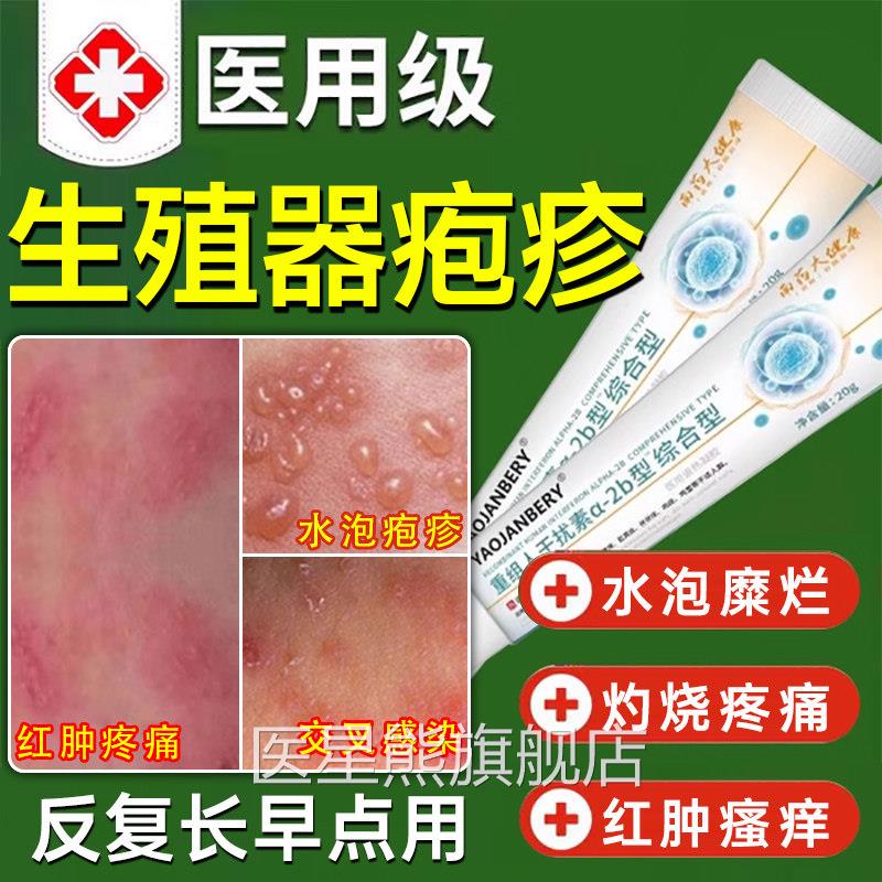 生殖器疱疹断男女真菌感染根药防复发克星疱本立停亭喷剂病毒日UU