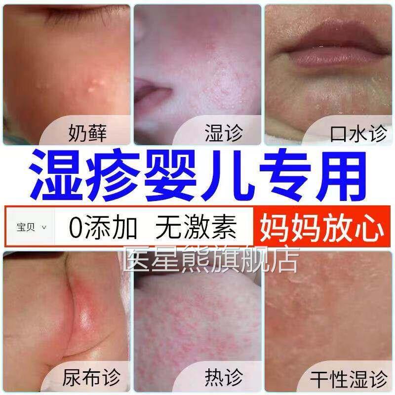 紫花地丁婴儿用紫可搭药膏官方旗舰店草膏舒缓湿奶癣疹止痒抑菌膏