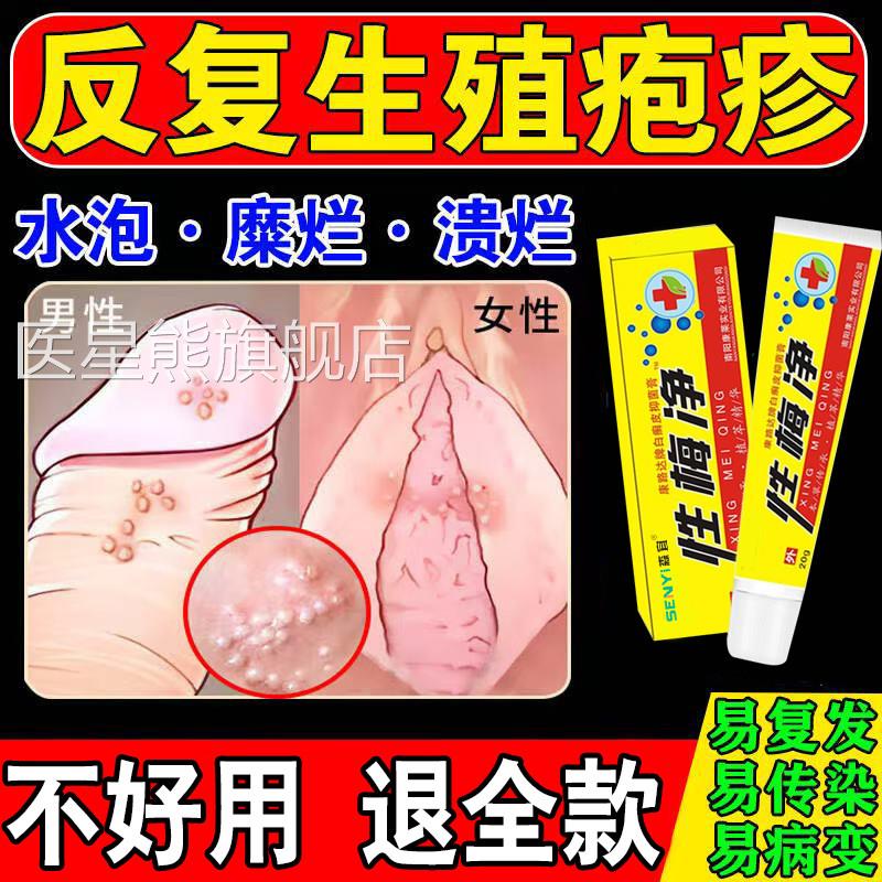 生殖器疱疹可搭配膏药贴疱疹断疱疹疹真菌感染根私处防复发器泡清