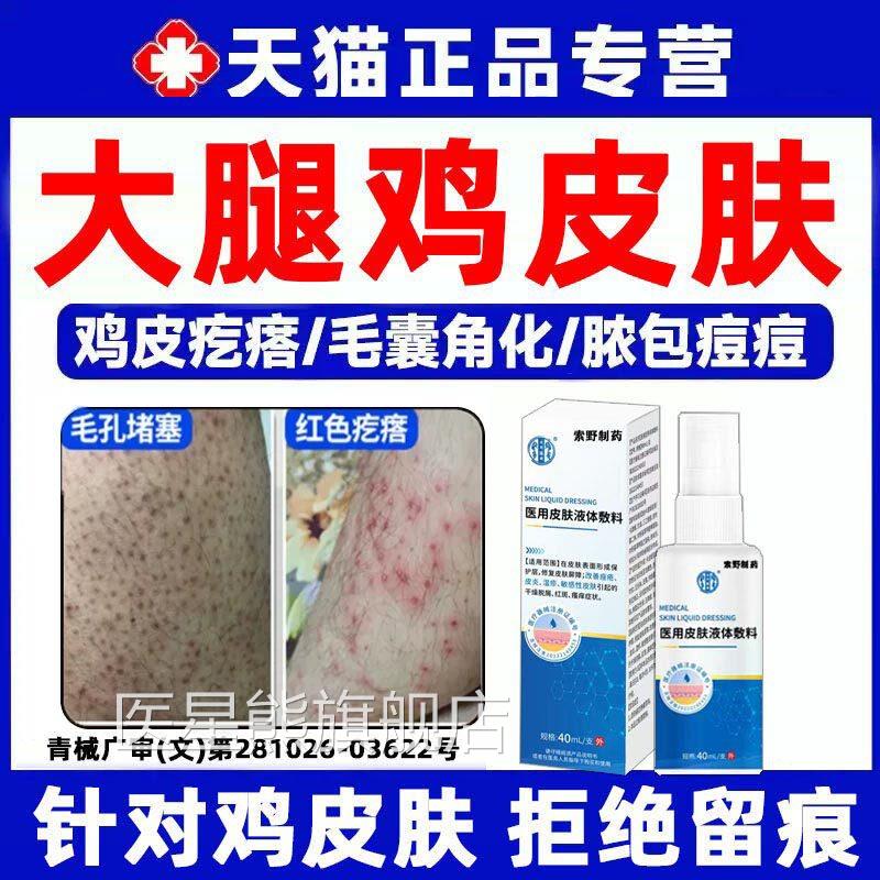 腿部毛囊炎鸡皮肤疙瘩毛囊角化症用去除全身手臂药房同售膏Q专Q医
