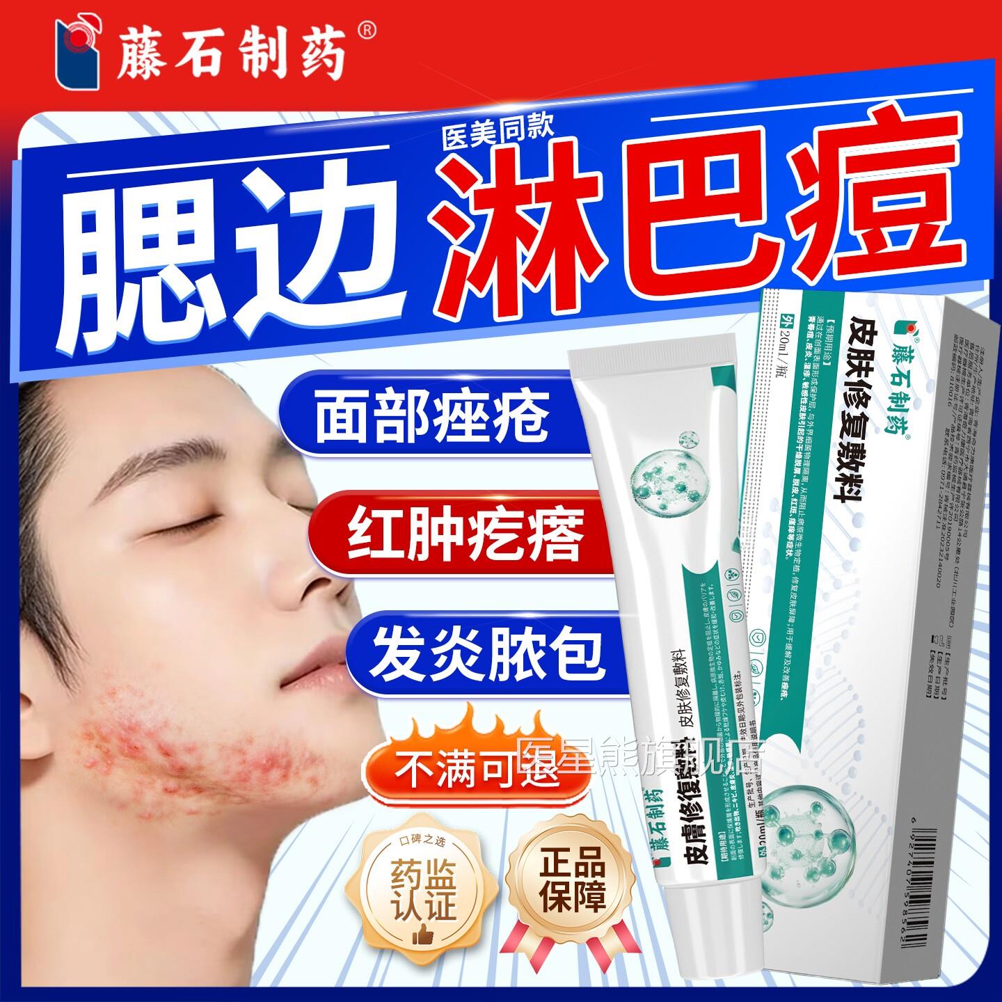 腮边淋巴毛痘专用膏男生下巴反复长痘痘痤疮脓包囊炎药房同售YI医