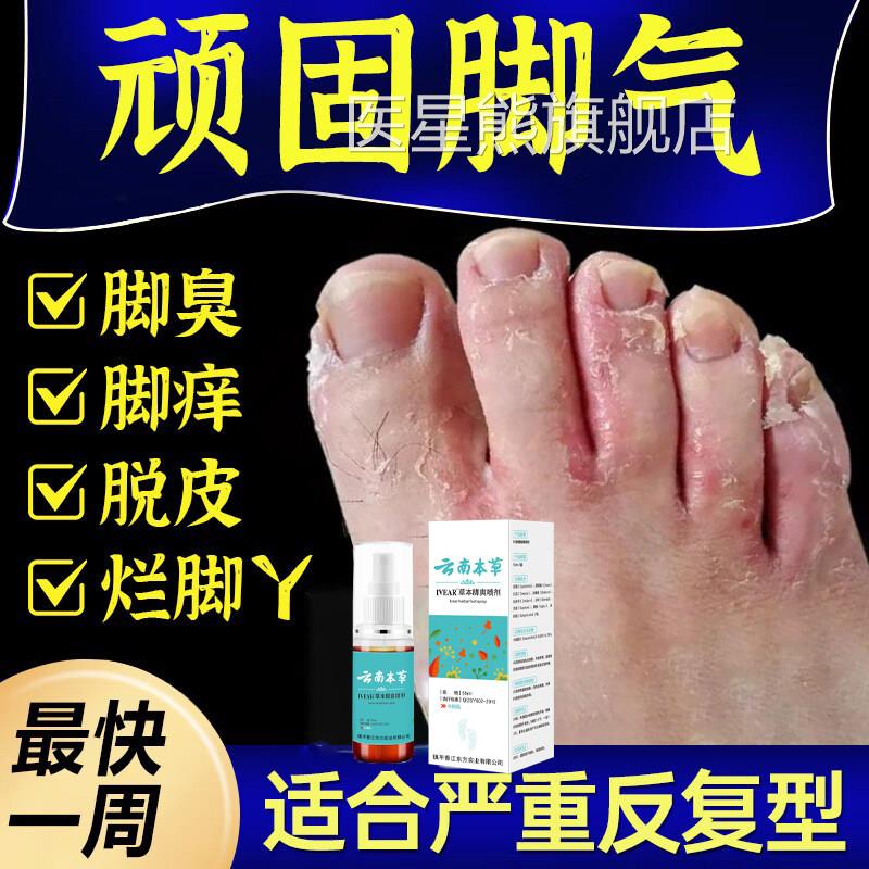 脚气止痒脱皮真杀菌脚痒水泡烂脚丫菌喷雾膏非药治糜烂脚趾缝烂痒