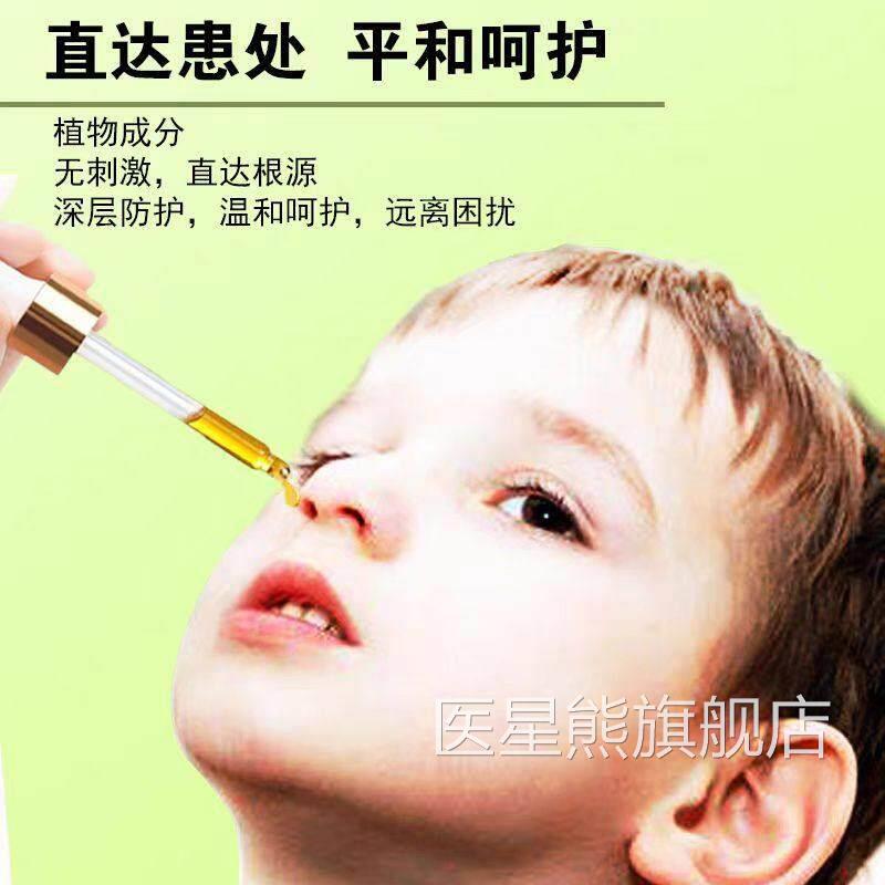 云油南本草耳子鼻炎鼻液苍草成人儿YBU童鹅不食鼻干鼻滴塞护通鼻