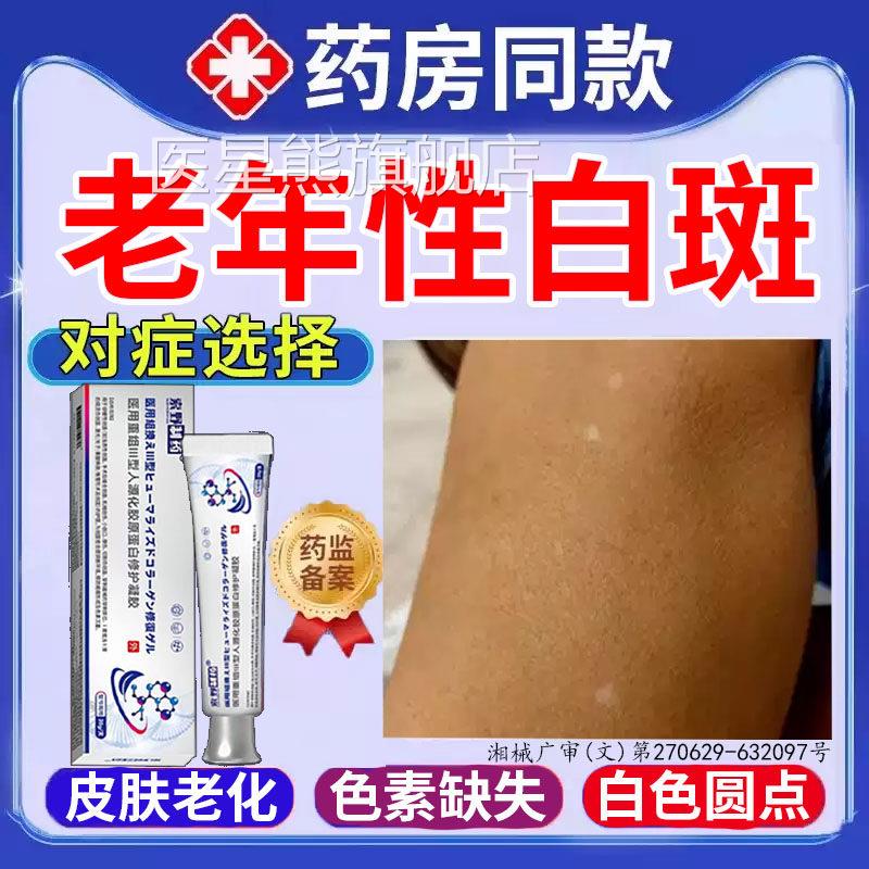 年老性白斑皮肤黄褐斑老年斑去凝胶专用手背部脸部白点药房同售BD