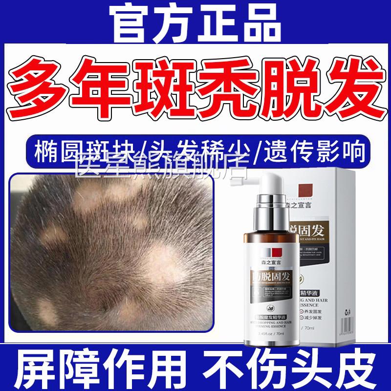 斑秃效特治鬼剃头药疗生发液增男女发防脱发洗发水地中海快速生发