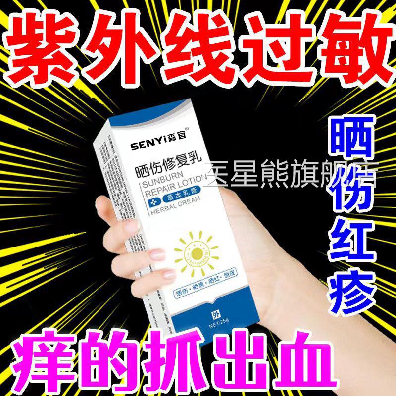 日光性皮炎去皮肤晒伤修防复乳根晒霜除治紫外线过敏专门用药膏医