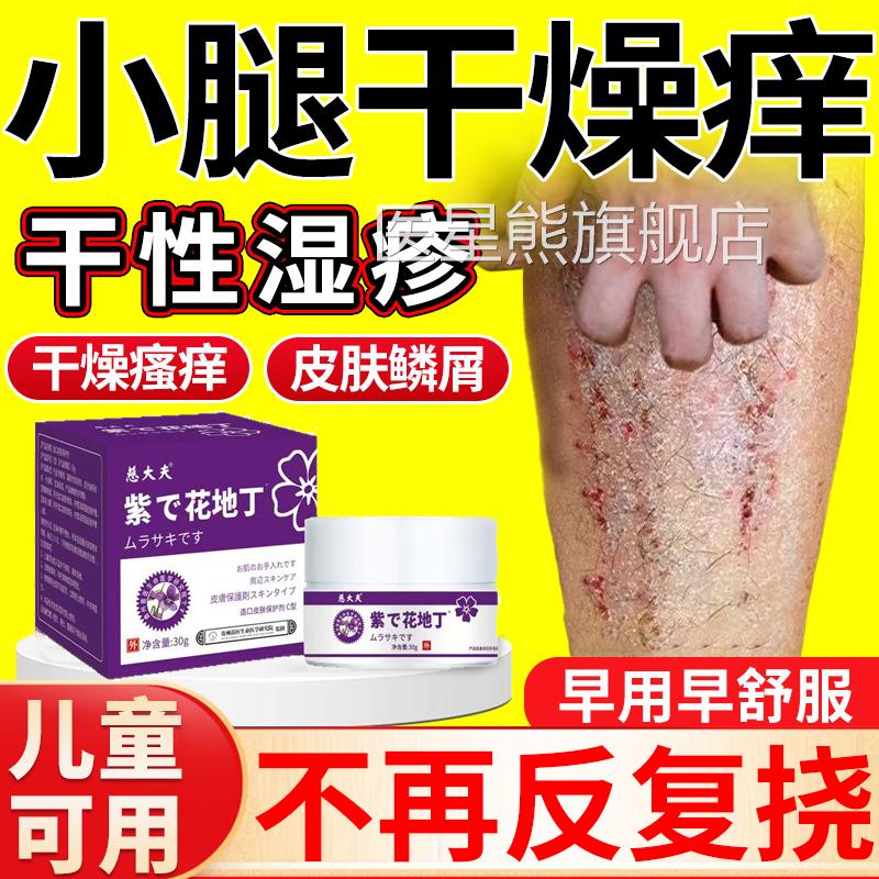 皮肤干燥瘙痒补止痒抑菌膏水保湿冬天小腿痒干性湿痒疹药膏凡士林