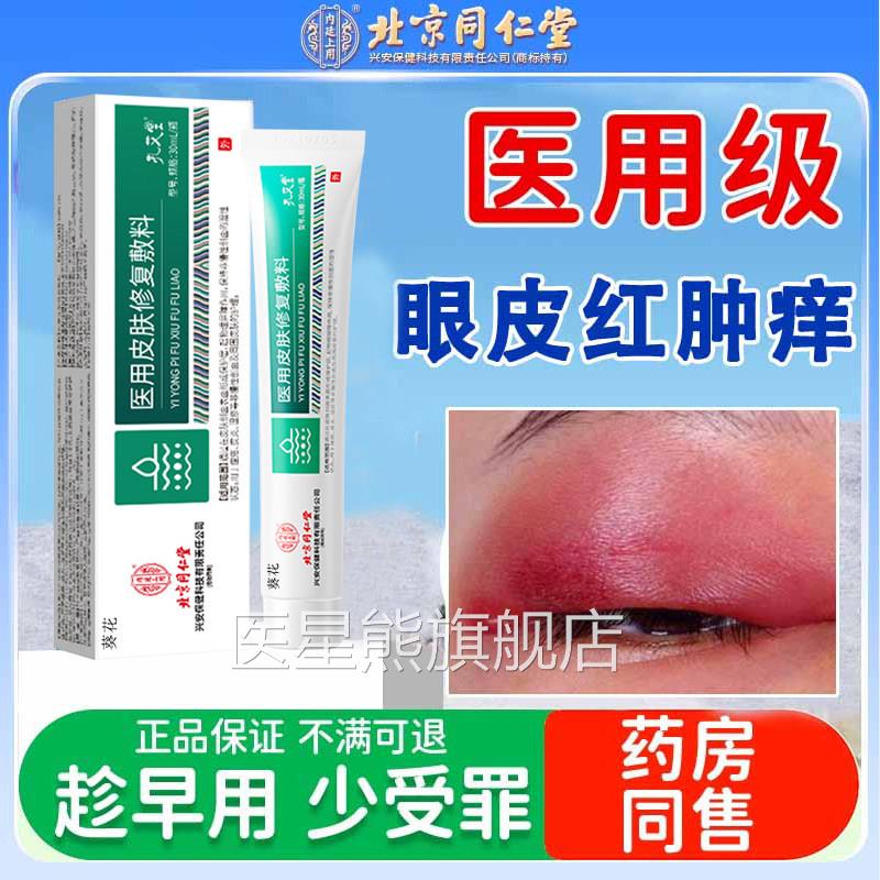 眼皮红肿痒眼睛角周围过敏发痒癣神经性皮炎眼痒干燥起皮掉屑RS医
