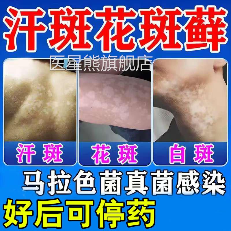 汗斑专用汗斑净汉斑香露花斑藓膏非药皮肤去汗斑专用特效喷雾剂皂